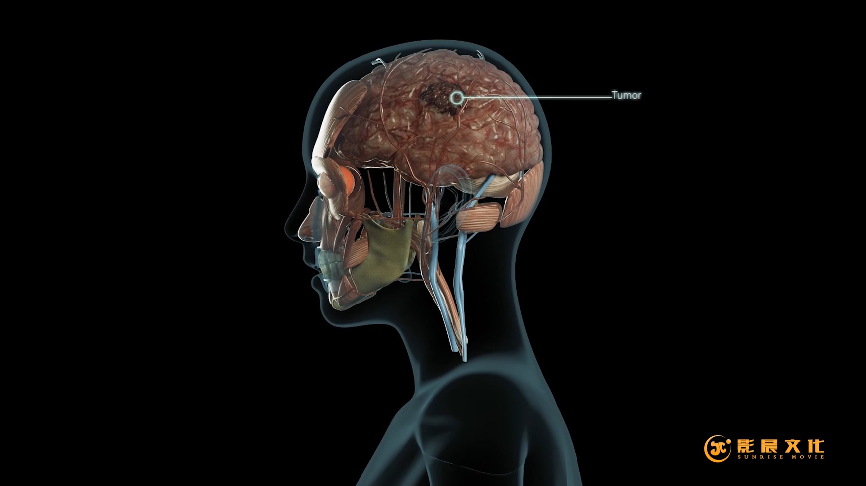 廣州醫(yī)學(xué)三維動(dòng)畫制作有哪些特點(diǎn)？