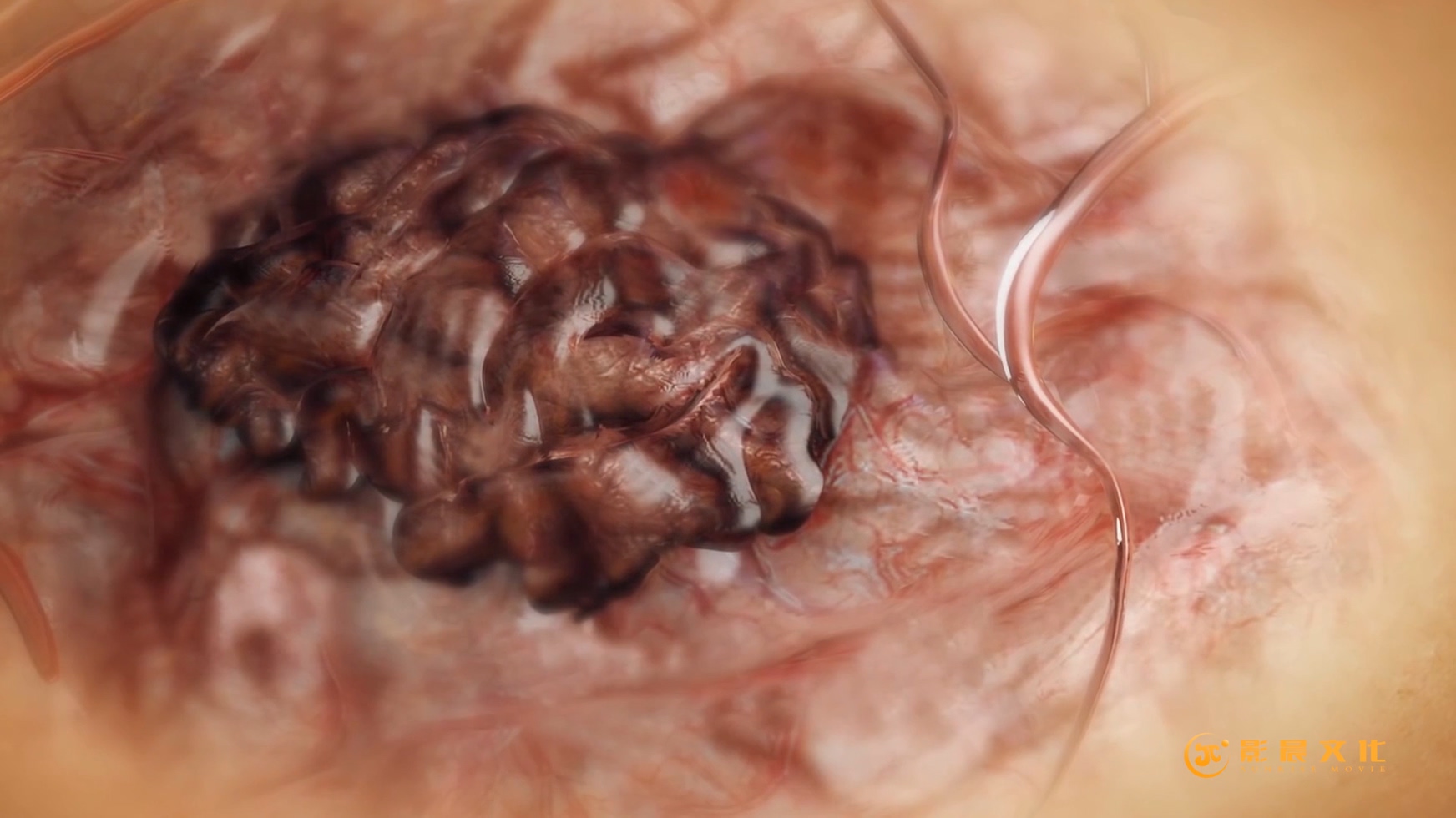 廣州醫(yī)學(xué)三維動畫